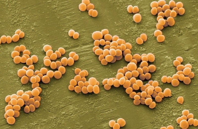 Συμπτώματα του Staphylococcus: Πώς εκδηλώνεται η ασθένεια