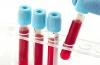 Antistreptolysin O (aslo) in the blood: what is it, norm by age, interpretation of results, therapy Antistreptolysin O blood test interpretation