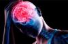 Закупорка сосудов головного мозга: симптомы и особенности лечения